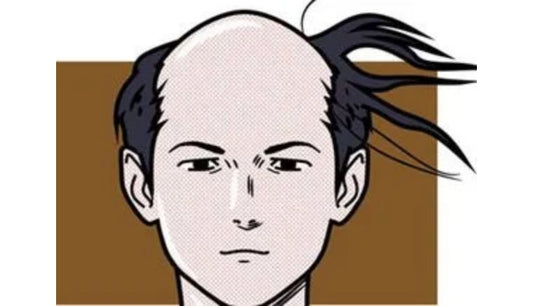 你戴假发最尴尬的经历是什么